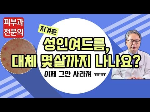 大人ニキビ、良くなれる？（ニキビを消す方法）
