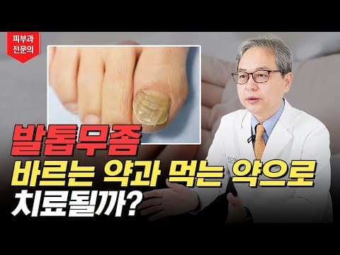 Toenail Fungus: Oral Vs Topical Medication, How Well Do They Cure It?