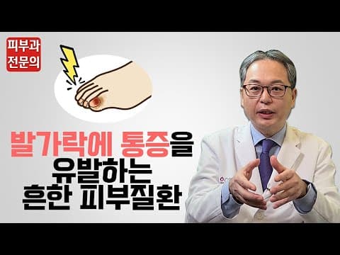 引起脚趾疼痛的常见皮肤病