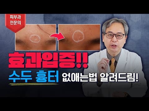 陈旧的水痘疤痕也能彻底去除吗 论文实证