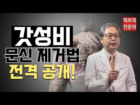 ［タトゥー除去］時間と費用を節約するタトゥー除去のコスパ最強の秘訣
