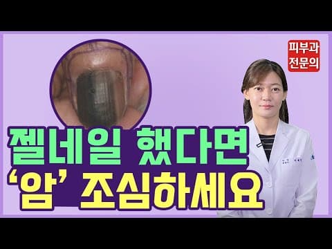 Nail Art Pedicure And Gel Nail Stickers Beware Of This Black Nail Streak Condition