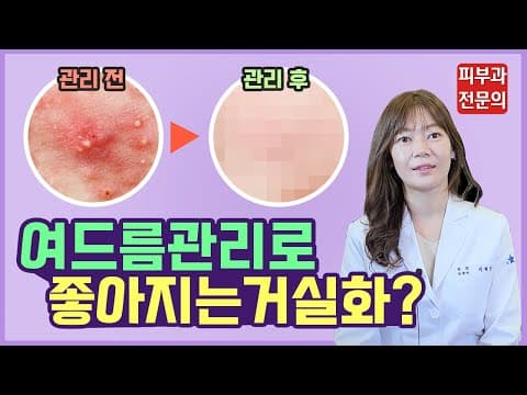 ニキビは管理だけでも良くなる？｜白ニキビ・化膿性ニキビを消す方法 スキンケア