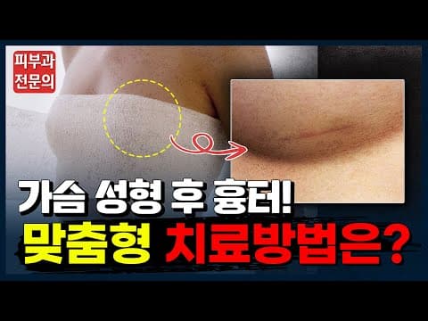 Breast Augmentation Scar Removal Without Additional Surgery
