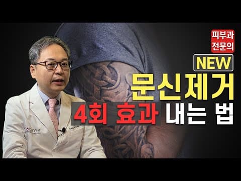 タトゥー除去4回分の効果を出す方法！回数を減らす新しい治療法！