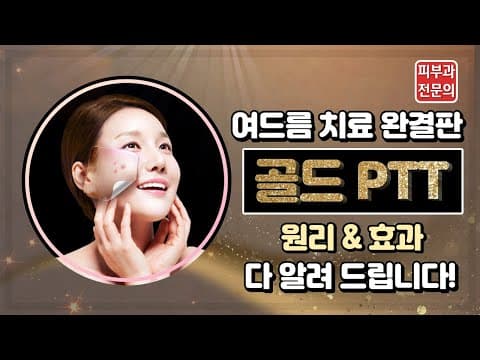 Gold PTT The Ultimate Acne Treatment Know It Accurately Before Treatment