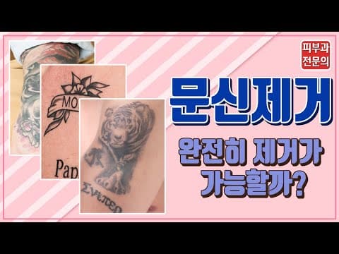 Must Watch Before Tattoo Removal By A Dermatologist