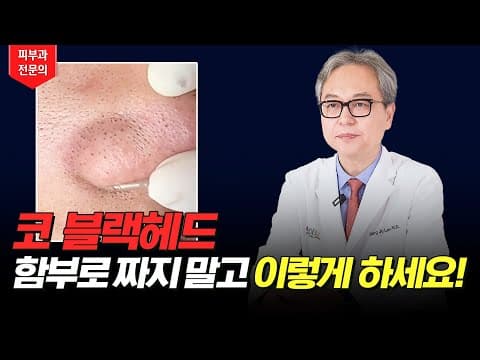 Blackhead Removal: A Dermatologist Shows You How To Get Rid Of Them