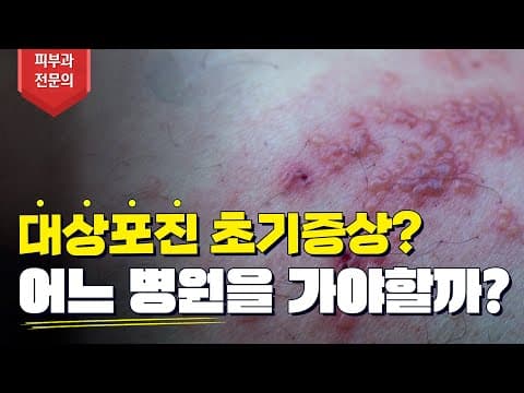 帯状疱疹の症状 治療 痛み 傷跡治療を5分で解決
